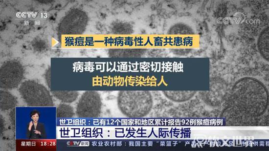 猴痘病毒中國有嗎？感染會出現什么癥狀？